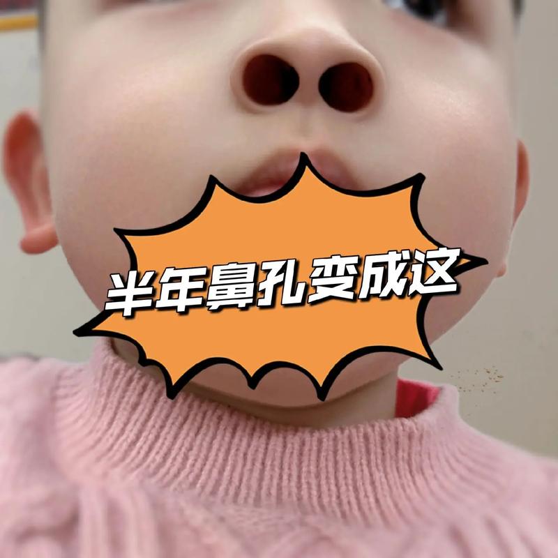 2025全年资料大全正版和挖鼻孔满脸肿胀变形与挖鼻孔满脸肿胀变形怎么办