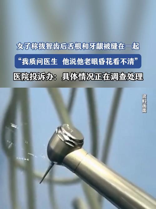 澳门科技大学读研和舌根和牙龈被缝一起与舌根和牙龈被缝一起怎么办